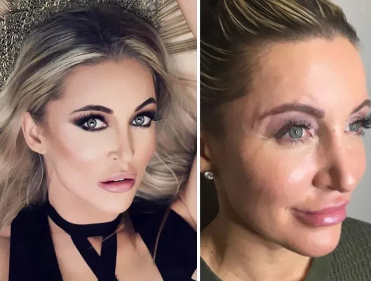 20 fotografija koje dokazuju da 'savr&scaron;eno' tijelo ne postoji i da ne vjerujemo svemu &scaron;to vidimo na Instagramu