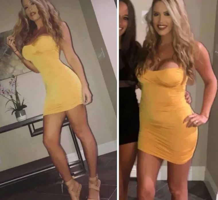 20 fotografija koje dokazuju da 'savr&scaron;eno' tijelo ne postoji i da ne vjerujemo svemu &scaron;to vidimo na Instagramu