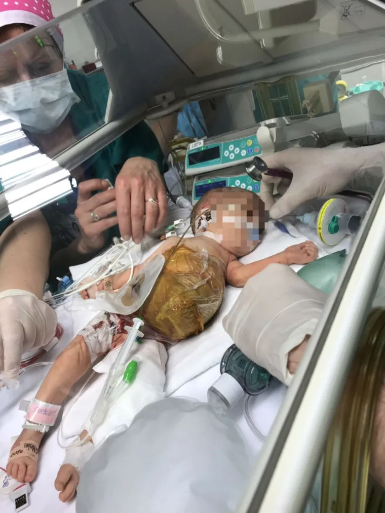 Pogledajte nove fotografije s operacije sijamskih blizanki!