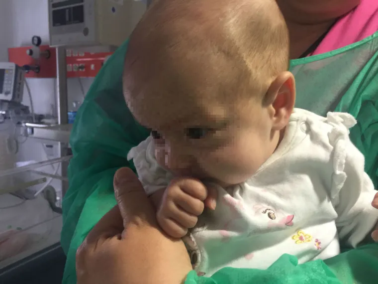 Pogledajte nove fotografije s operacije sijamskih blizanki!