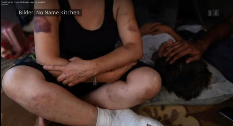 BRUTALNO POSTUPANJE: Hrvatska policija migrantima nanijela tjelesne ozljede