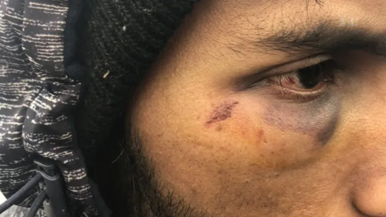 BRUTALNO POSTUPANJE: Hrvatska policija migrantima nanijela tjelesne ozljede