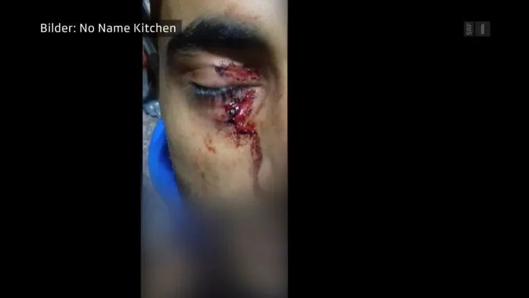 BRUTALNO POSTUPANJE: Hrvatska policija migrantima nanijela tjelesne ozljede