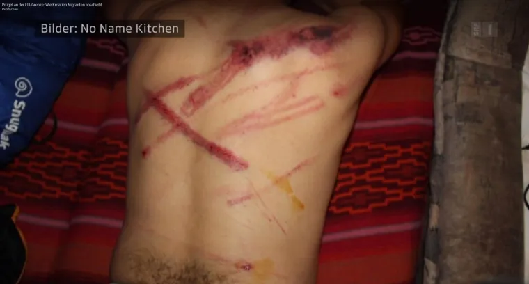 BRUTALNO POSTUPANJE: Hrvatska policija migrantima nanijela tjelesne ozljede