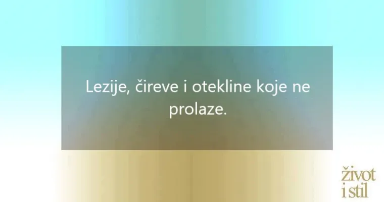 I kućni ljubimci mogu oboljeti od melanoma: ovo su simptomi raka kože kod pasa i mačaka