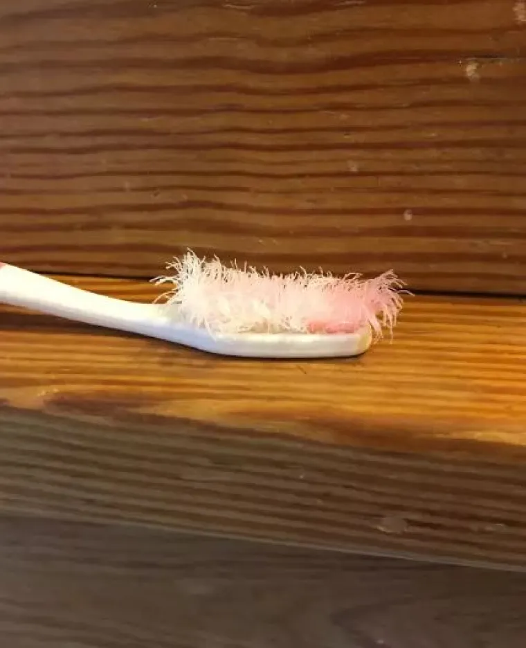 Nije za one slabog želuca: 15 fotografija ljudi koji žive s 'kraljevima neurednosti'