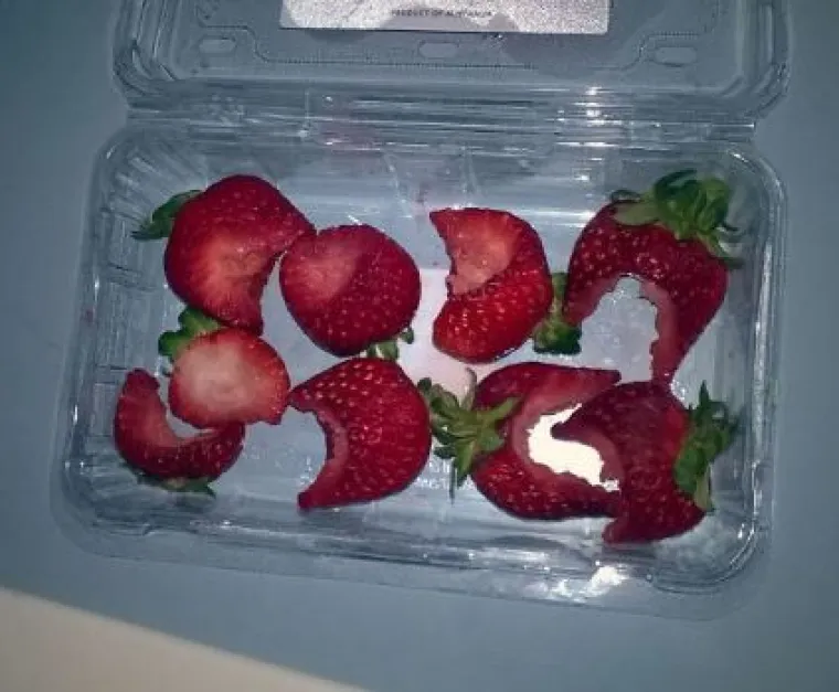 Nije za one slabog želuca: 15 fotografija ljudi koji žive s 'kraljevima neurednosti'