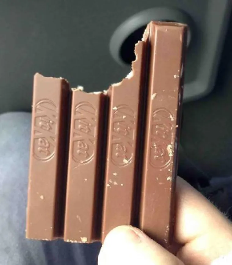 Nije za one slabog želuca: 15 fotografija ljudi koji žive s 'kraljevima neurednosti'