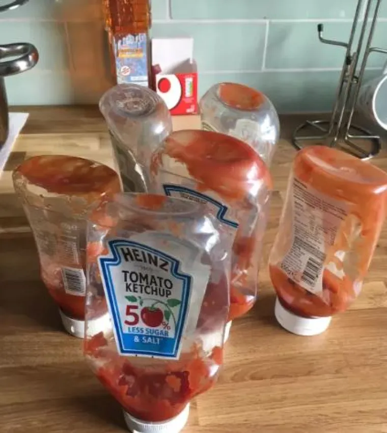 Nije za one slabog želuca: 15 fotografija ljudi koji žive s 'kraljevima neurednosti'