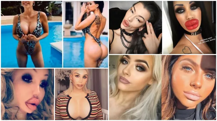 20 osoba koje su 'malo' pretjerale s plastičnim operacijama, njihove slike postale su viralne