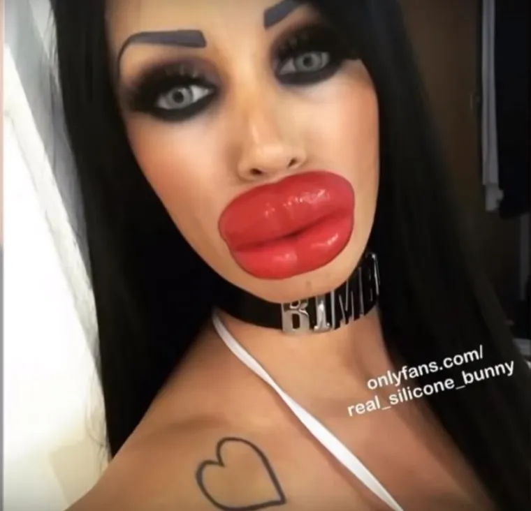 20 osoba koje su 'malo' pretjerale s plastičnim operacijama, njihove slike postale su viralne