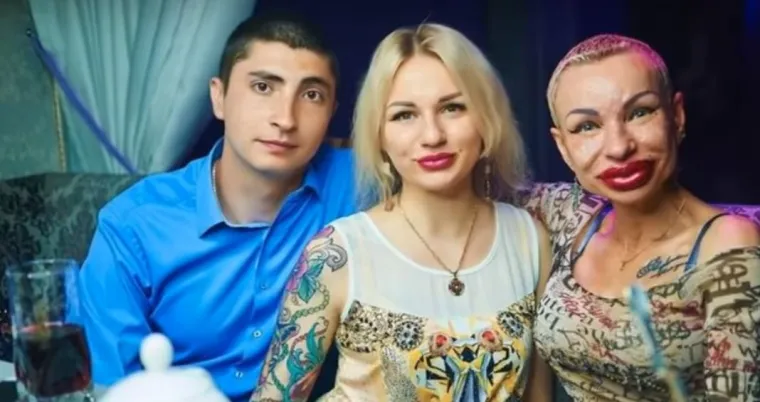 20 osoba koje su 'malo' pretjerale s plastičnim operacijama, njihove slike postale su viralne