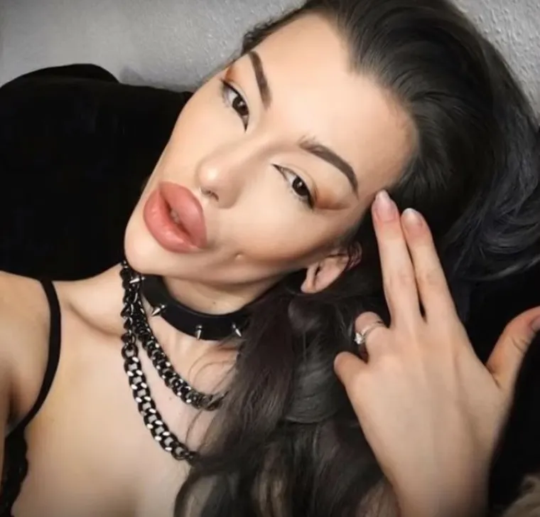 20 osoba koje su 'malo' pretjerale s plastičnim operacijama, njihove slike postale su viralne