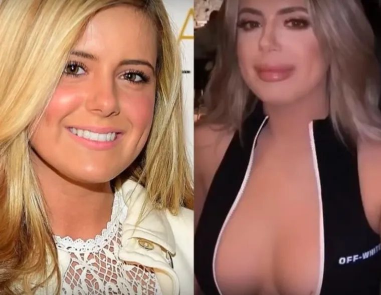 20 osoba koje su 'malo' pretjerale s plastičnim operacijama, njihove slike postale su viralne