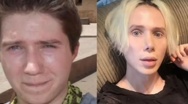 20 osoba koje su 'malo' pretjerale s plastičnim operacijama, njihove slike postale su viralne