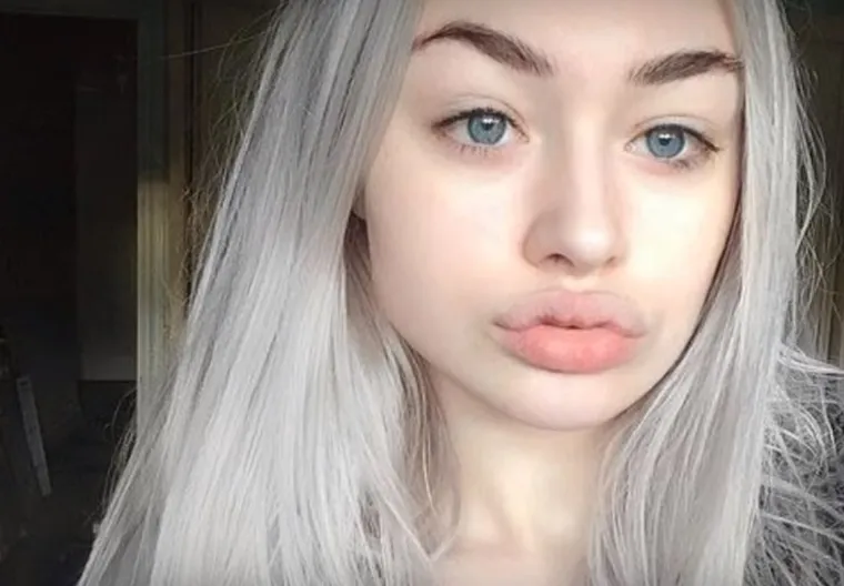 20 osoba koje su 'malo' pretjerale s plastičnim operacijama, njihove slike postale su viralne