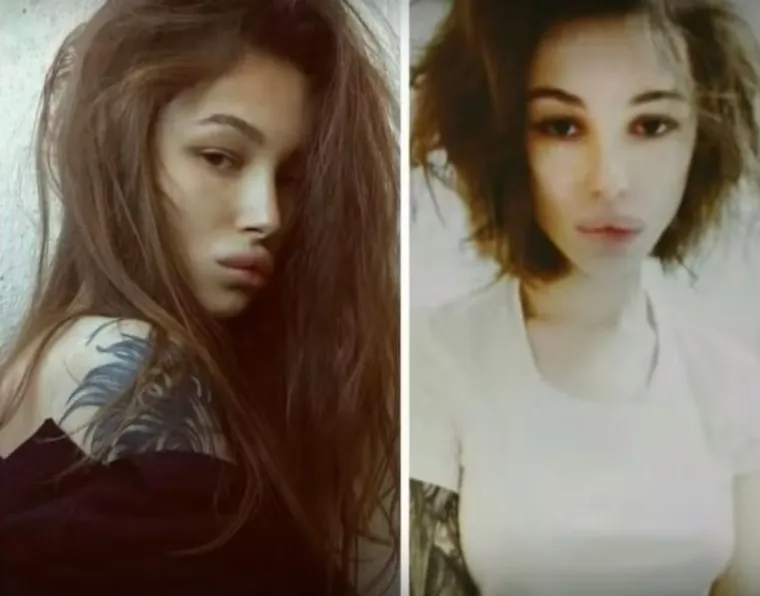 20 osoba koje su 'malo' pretjerale s plastičnim operacijama, njihove slike postale su viralne