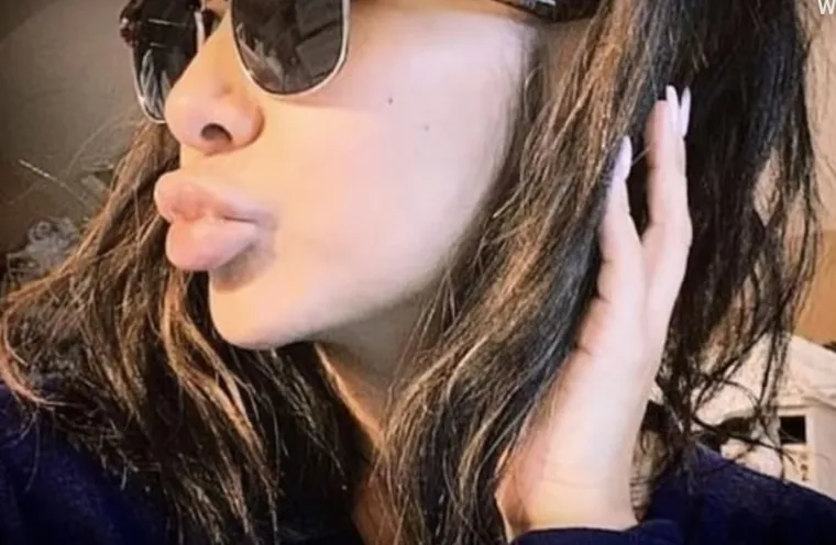 20 osoba koje su 'malo' pretjerale s plastičnim operacijama, njihove slike postale su viralne