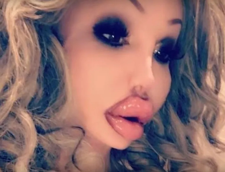 20 osoba koje su 'malo' pretjerale s plastičnim operacijama, njihove slike postale su viralne