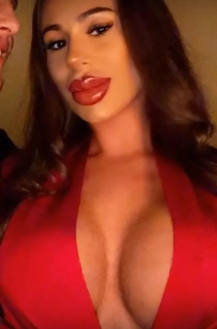 20 osoba koje su 'malo' pretjerale s plastičnim operacijama, njihove slike postale su viralne