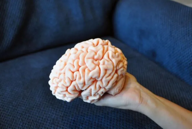 3D print mozga nakon skeniranja