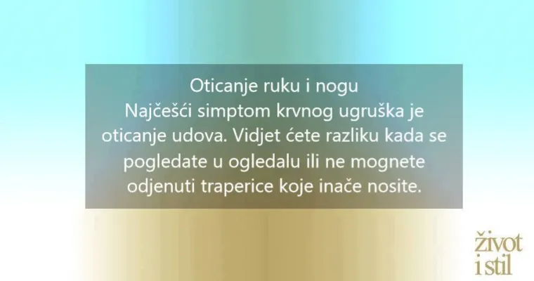 10 simptoma koji ukazuju na to da možda imate krvni ugru&scaron;ak u tijelu