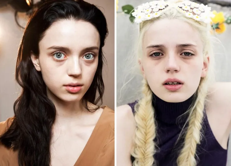 Ovo su 'najčudniji' modeli koji dokazuju da ne postoji samo jedna vrsta ljepote