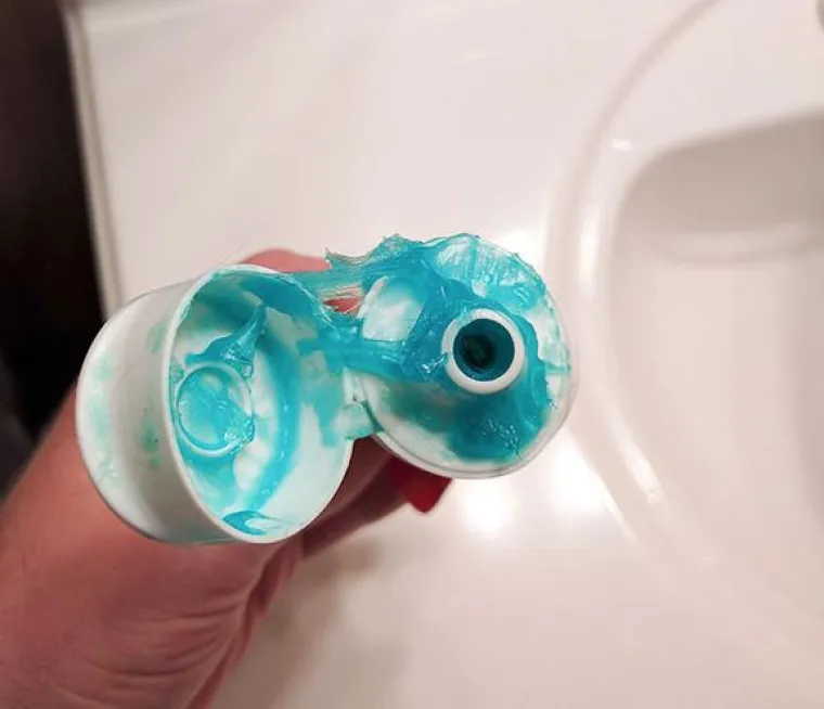 Nije za svakoga: 20 neugodno nelagodnih fotografija zbog kojih će vas proći trnci