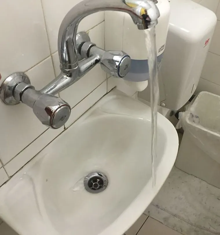 Nije za svakoga: 20 neugodno nelagodnih fotografija zbog kojih će vas proći trnci