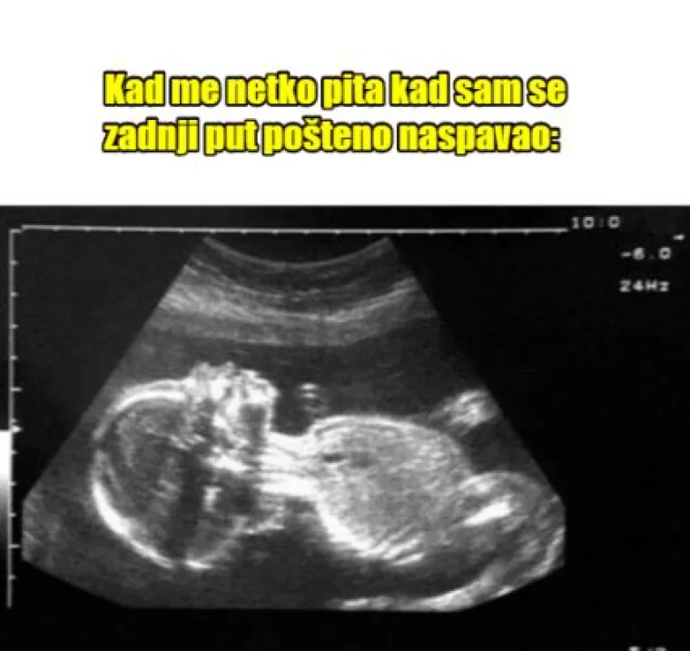 15 duhovitih, a realnih mema za sve nas koji volimo dugo spavati