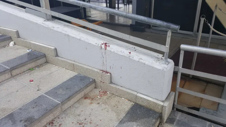 Užas u Splitu: Objavljene uznemirujuće fotografije napada na Bačvicama