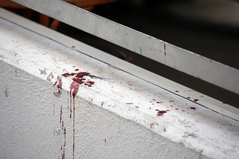 Užas u Splitu: Objavljene uznemirujuće fotografije napada na Bačvicama