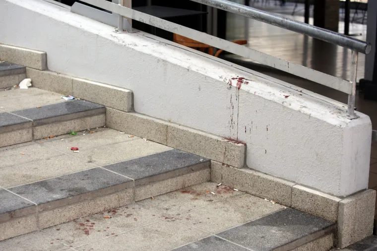 Užas u Splitu: Objavljene uznemirujuće fotografije napada na Bačvicama