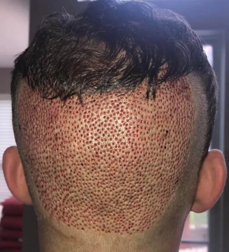 Bolujete li od tripofobije? Ove fotografije su nama zgadile život, tako da mi vjerojatno bolujemo