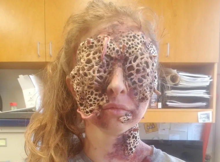 Bolujete li od tripofobije? Ove fotografije su nama zgadile život, tako da mi vjerojatno bolujemo