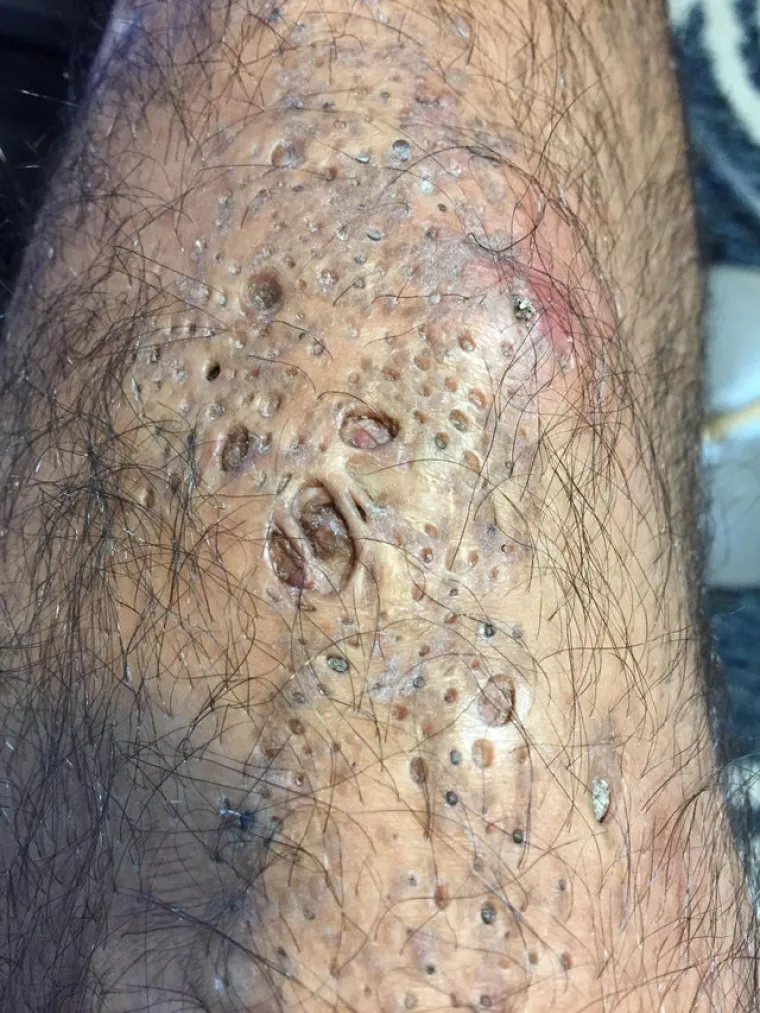 Bolujete li od tripofobije? Ove fotografije su nama zgadile život, tako da mi vjerojatno bolujemo