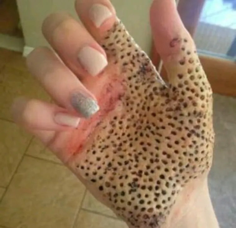 Bolujete li od tripofobije? Ove fotografije su nama zgadile život, tako da mi vjerojatno bolujemo