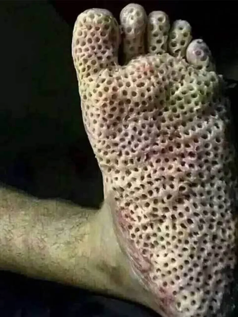 Bolujete li od tripofobije? Ove fotografije su nama zgadile život, tako da mi vjerojatno bolujemo