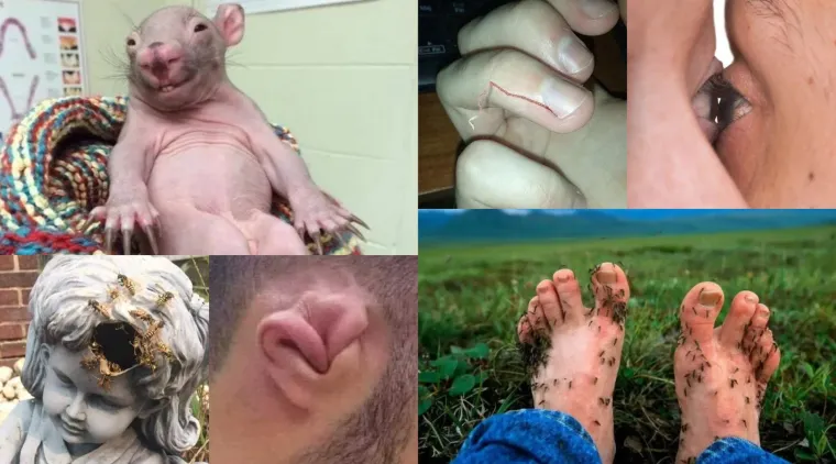 Nije za gadljive: 20 slika koje vam danima neće moći izaći iz glave