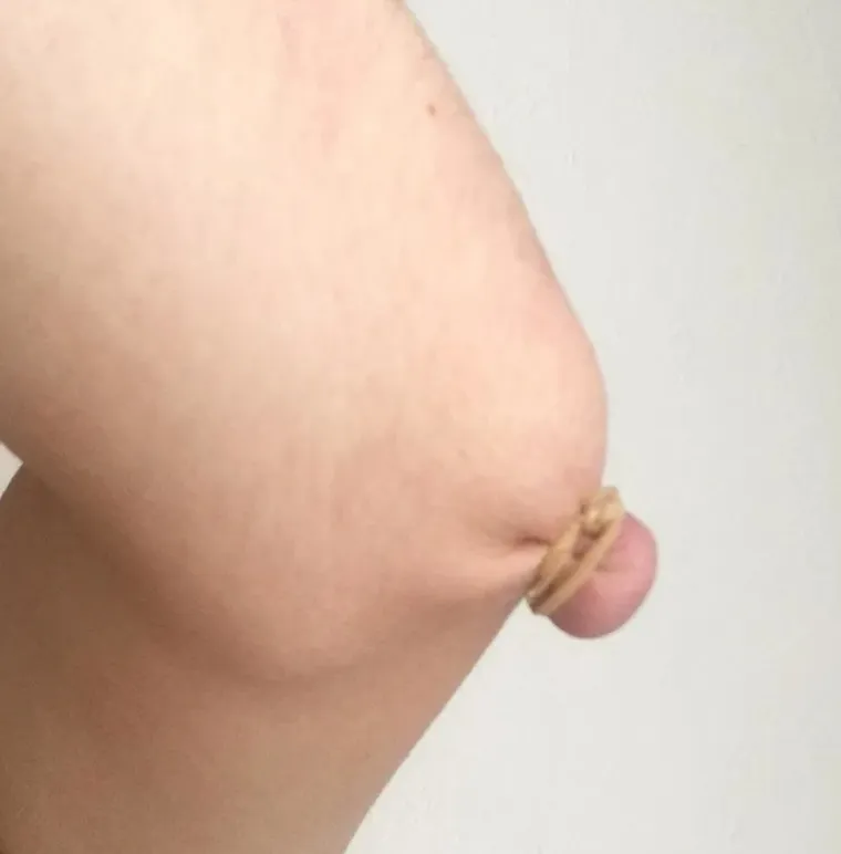 Nije za gadljive: 20 slika koje vam danima neće moći izaći iz glave