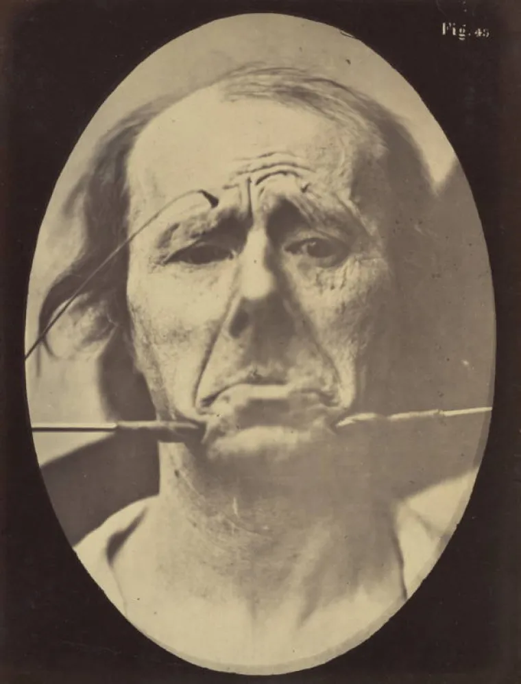 JEZIVE SLIKE LIJEČNIČKIH POKUSA IZ 19. STOLJEĆA: Ova lica će vas proganjati i dok spavate