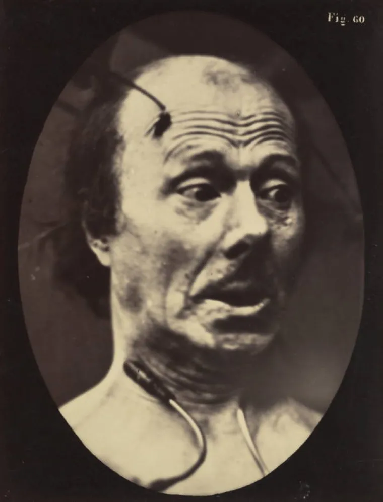 JEZIVE SLIKE LIJEČNIČKIH POKUSA IZ 19. STOLJEĆA: Ova lica će vas proganjati i dok spavate