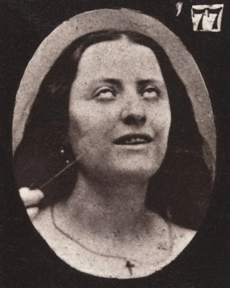 JEZIVE SLIKE LIJEČNIČKIH POKUSA IZ 19. STOLJEĆA: Ova lica će vas proganjati i dok spavate