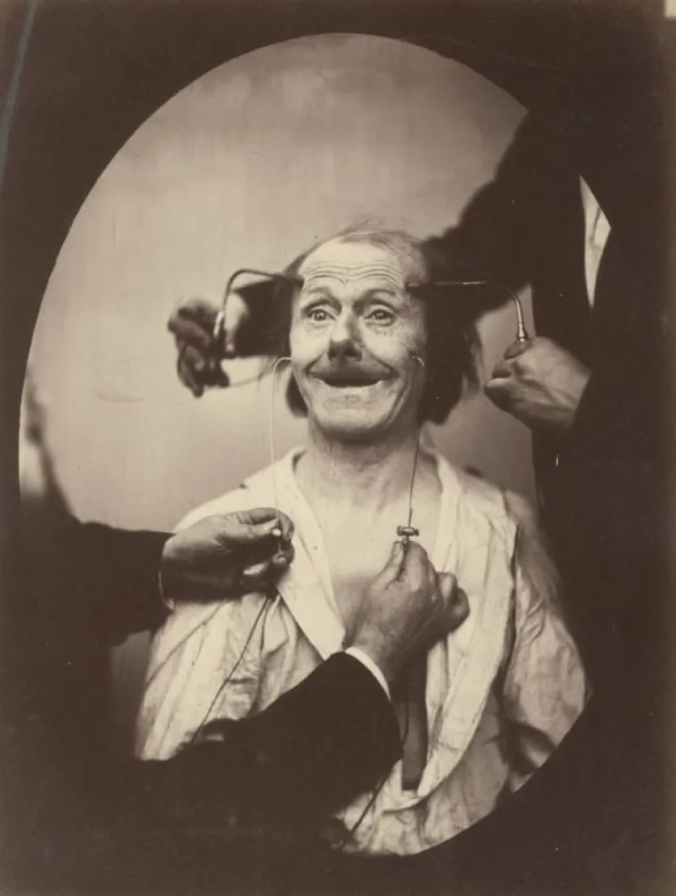 JEZIVE SLIKE LIJEČNIČKIH POKUSA IZ 19. STOLJEĆA: Ova lica će vas proganjati i dok spavate