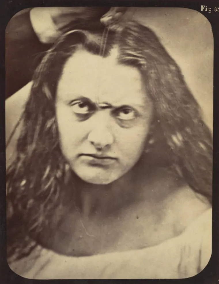 JEZIVE SLIKE LIJEČNIČKIH POKUSA IZ 19. STOLJEĆA: Ova lica će vas proganjati i dok spavate