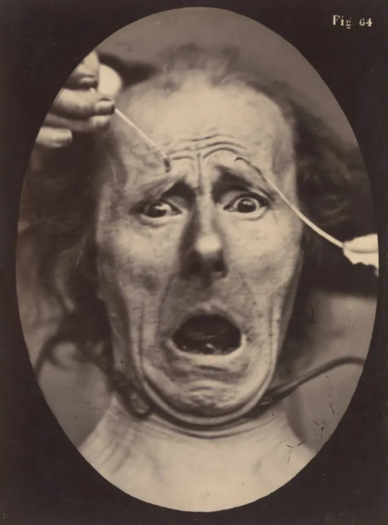 JEZIVE SLIKE LIJEČNIČKIH POKUSA IZ 19. STOLJEĆA: Ova lica će vas proganjati i dok spavate