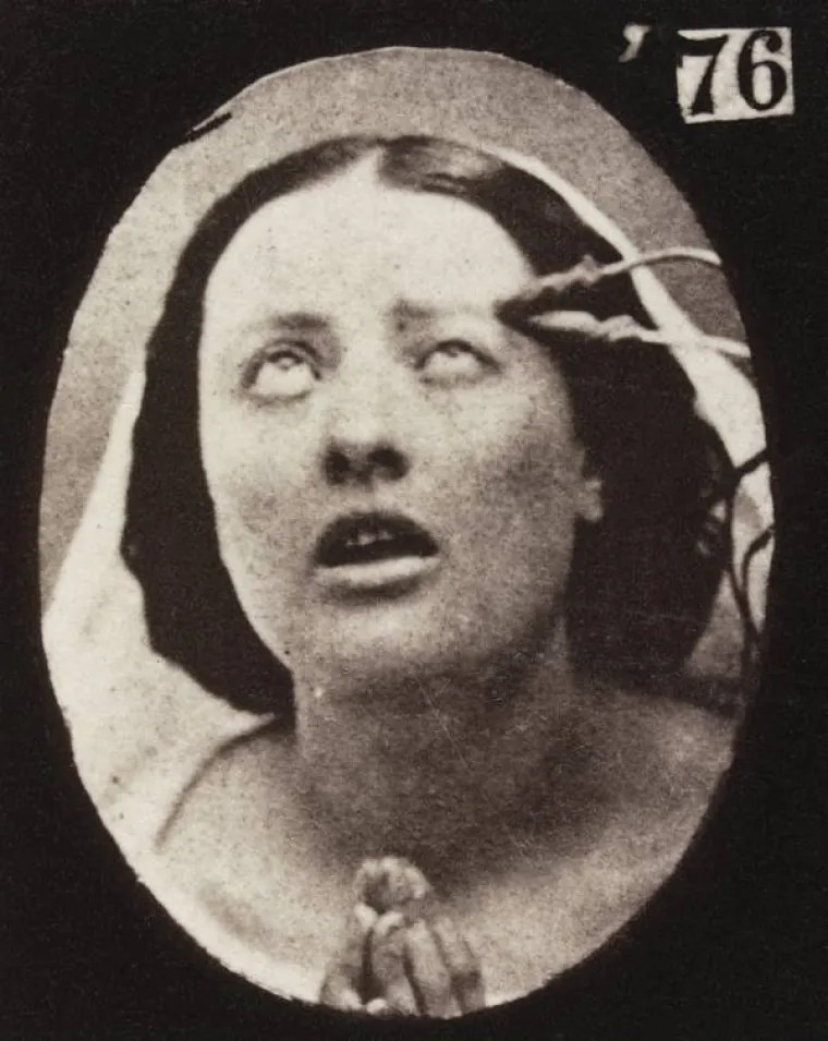 JEZIVE SLIKE LIJEČNIČKIH POKUSA IZ 19. STOLJEĆA: Ova lica će vas proganjati i dok spavate