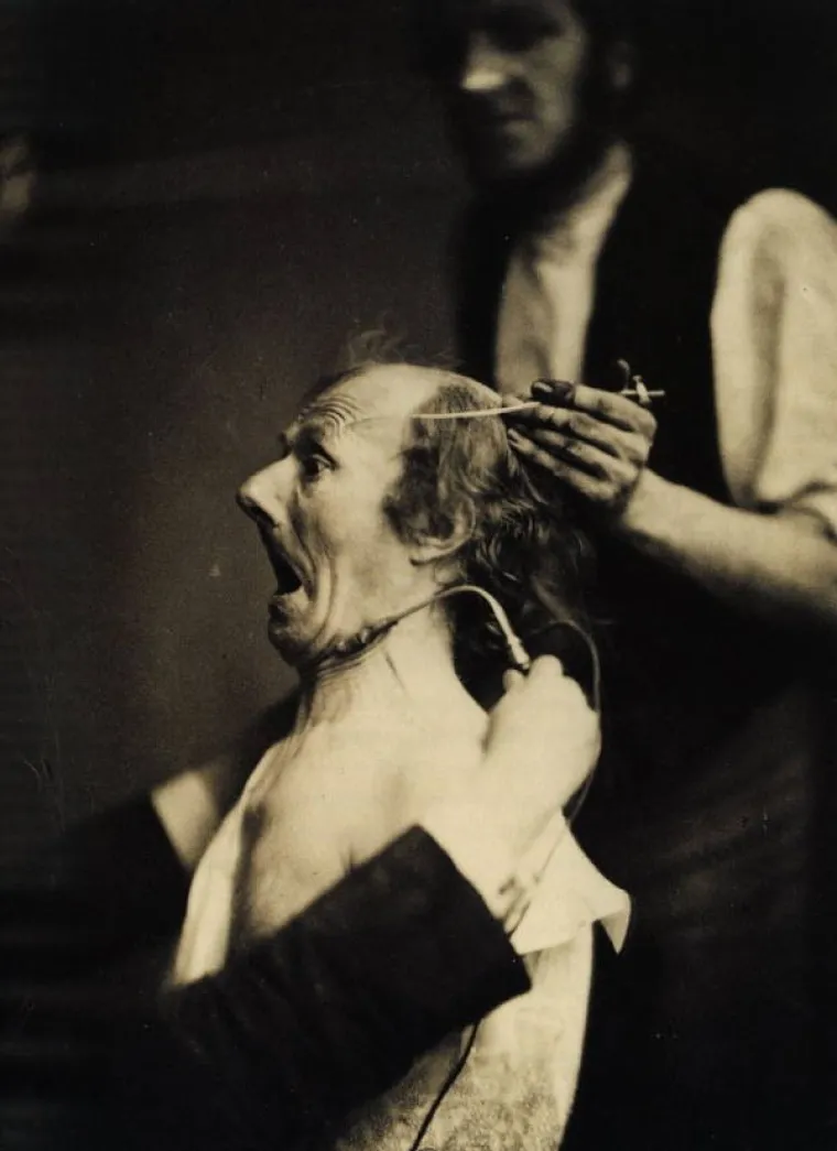 JEZIVE SLIKE LIJEČNIČKIH POKUSA IZ 19. STOLJEĆA: Ova lica će vas proganjati i dok spavate