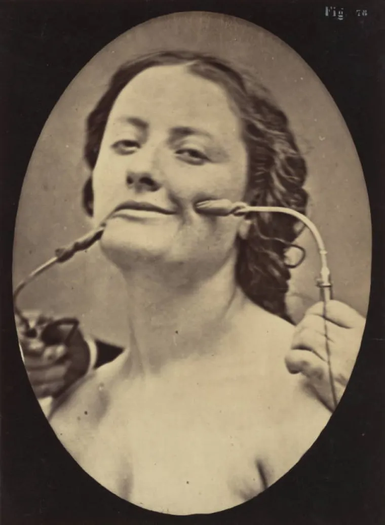 JEZIVE SLIKE LIJEČNIČKIH POKUSA IZ 19. STOLJEĆA: Ova lica će vas proganjati i dok spavate