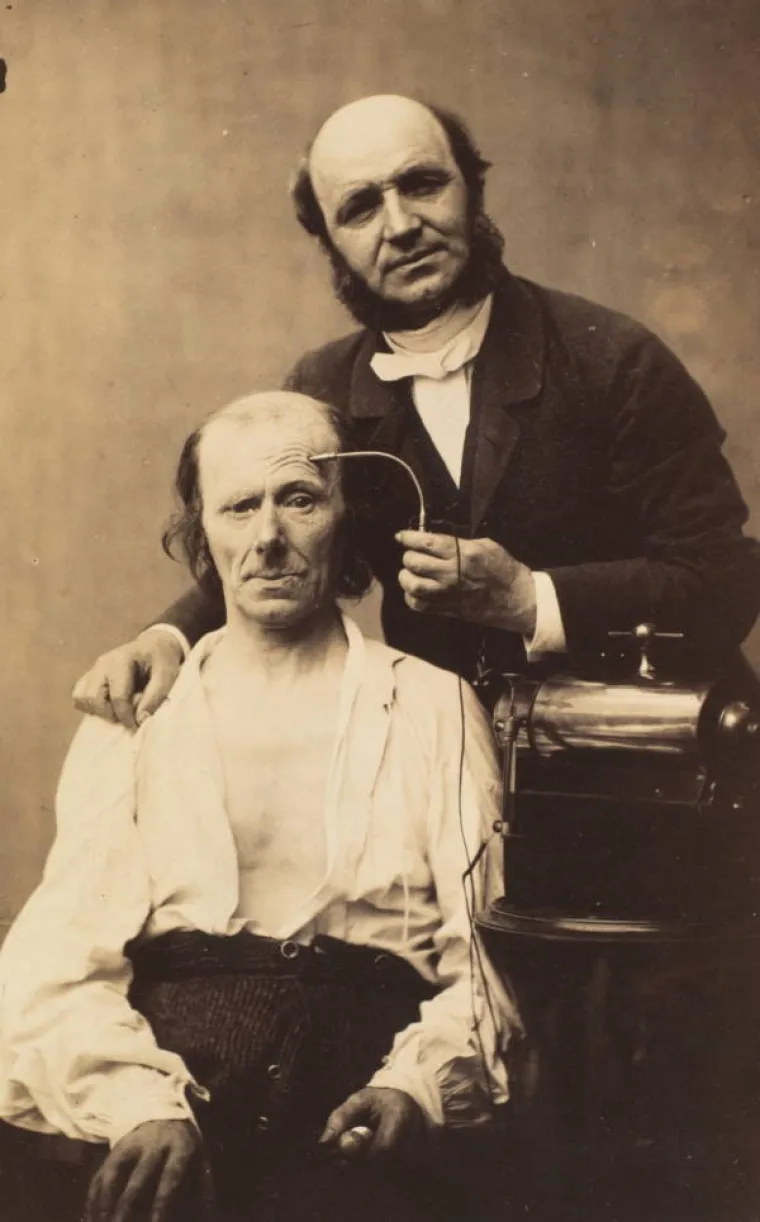 JEZIVE SLIKE LIJEČNIČKIH POKUSA IZ 19. STOLJEĆA: Ova lica će vas proganjati i dok spavate